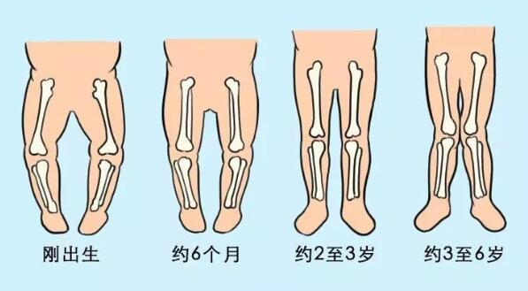 宝宝标准腿型长什么样？