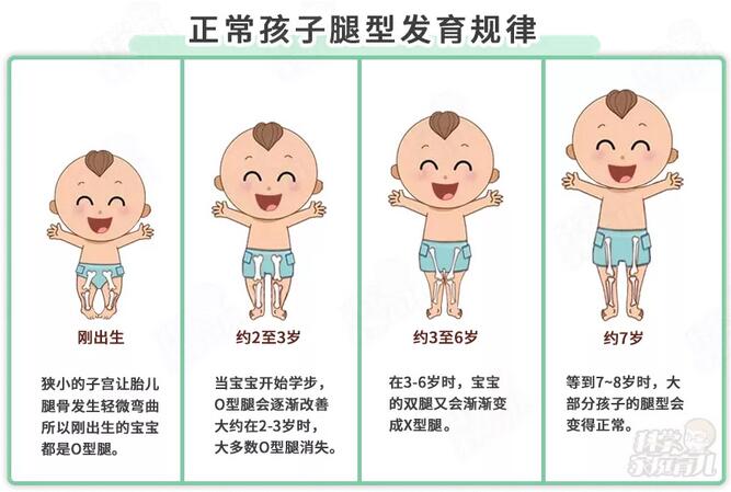 5个习惯最毁腿型，过早扶站、用学步车等