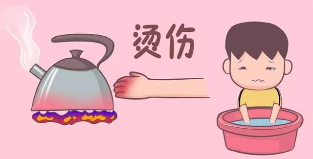 宝宝不小心烫伤了怎么办？记住这五字诀