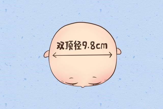 胎儿bpd是什么意思