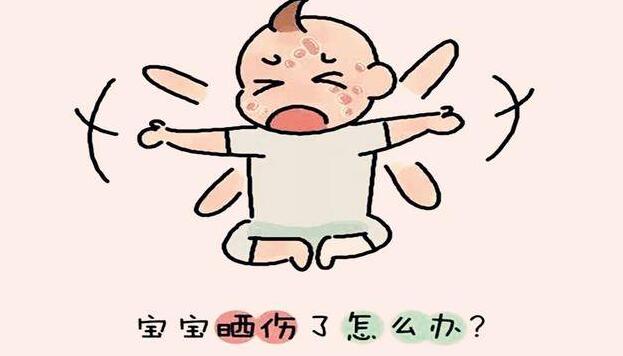 孩子晒伤了怎么办？